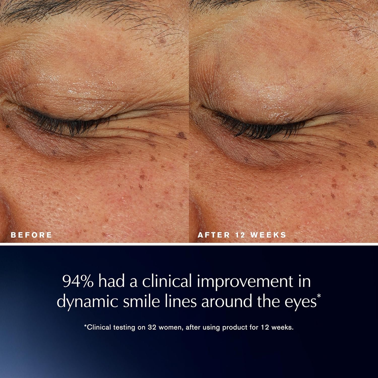 Estée Lauder Advanced Night Repair Eye Lift + Sculpt | Eye Cream with 2HA Volume Filler & Hexapeptide-8, 0.5 Fl Oz - Image 4